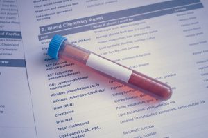 Medical lab form labeled 'Blood Chemistry Panel' with a blue-capped red blood sample tube resting on it, ready for testing
